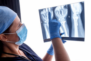 Portland Bone Fracture Attorney